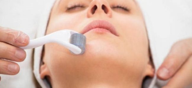 Microneedling Duluth