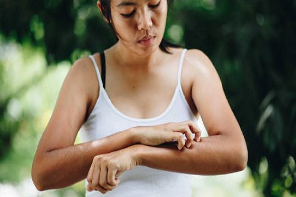 Xtrac Psoriasis Treatment Duluth
